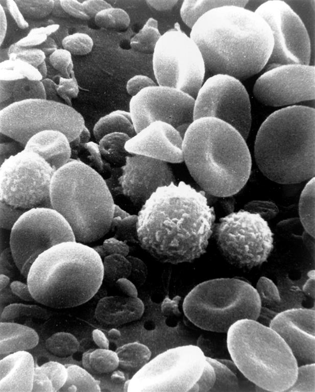 img-vac-04-SEM_blood_cells (Medium)