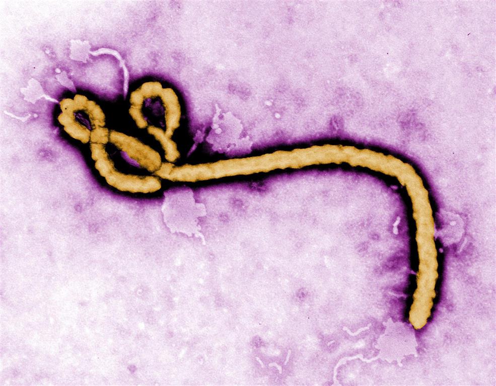 ímg-vac-s1-01-ebola (Medium)